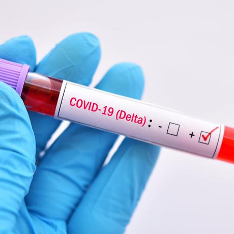 Síntomas de la variante Delta del Covid-19 más fáciles de diagnosticar-TuParadaDigital