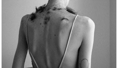 El miedo a la muerte por un diagnóstico tardío.     The fear of death due to a late diagnosis.     害怕因晚期诊断而死亡。