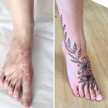 40 Personas que pidieron a tatuadores que cubrieran sus cicatrices y marcas de nacimiento y no pudieron estar más contentos con el resultado
