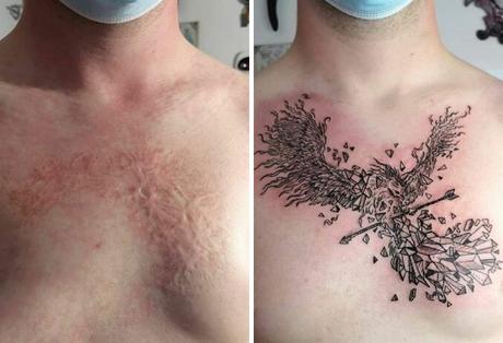 40 Personas que pidieron a tatuadores que cubrieran sus cicatrices y marcas de nacimiento y no pudieron estar más contentos con el resultado