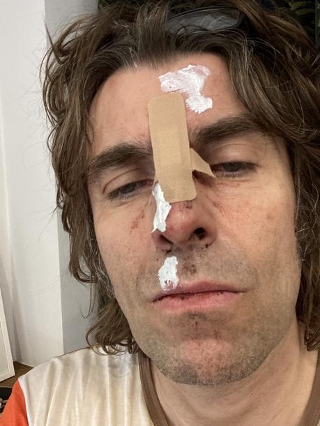 Liam Gallagher se cae desde un helicóptero