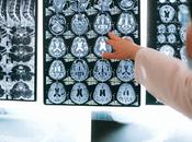 Apraxias: características, causas tipos