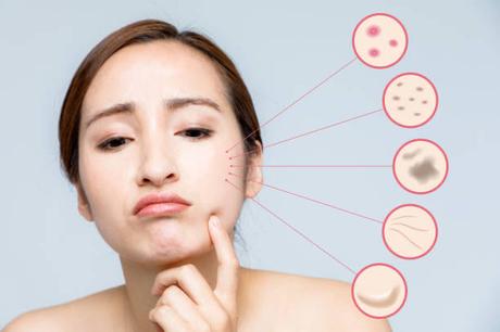Novedades de Montibello para el Cuidado de la Piel y el Cabello tras el Verano imperfecciones-piel