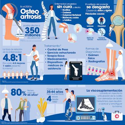 Osteoartrosis; una de las principales causas de discapacidad en el mundo
