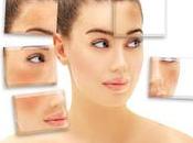 Cómo Quitar Manchas Piel