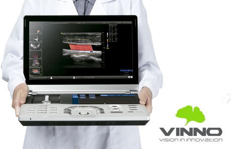 ¿Qué hay que tener en cuenta al comprar un ecógrafo portátil?, por ECOGRÁFOS VINNO