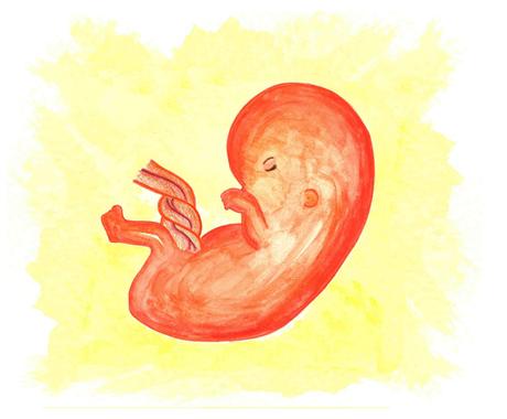 Con el manchado entre periodos, porque eso puede ayudar al médico a . Parir Los Restos Manejo Expectante Aborto Espontaneo El Parto Es Nuestro