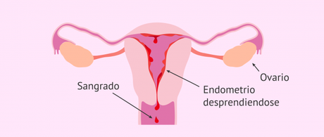 Y quieres saber en qué circunstancias deberás preocuparte y acudir al ginecólogo, sigue leyendo este artículo de uncomo porque te lo explicamos . Es Posible Que Ocurra La Ovulacion Y La Regla Al Mismo Tiempo