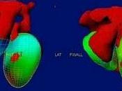 ¿Podría terapia genética reemplazar marcapasos?