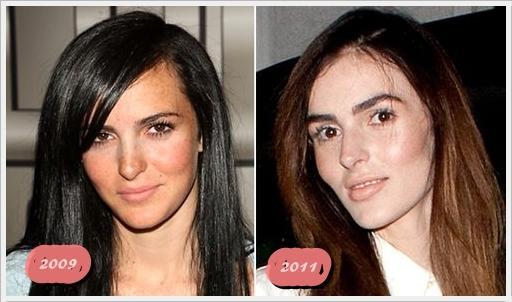 Ali Lohan: realidad o bisturí?