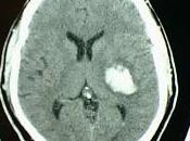 Nueva Epidemia Enfermedades Transmisibles