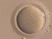 Donación óvulos espermatozoides ¿sabes consiste?