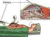 Respuesta negligencia médica Cuba