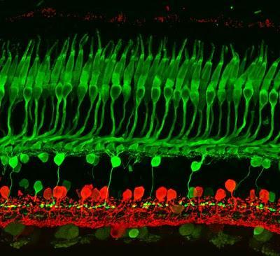 Retina retina, ojo, calbindina, fotorreceptor