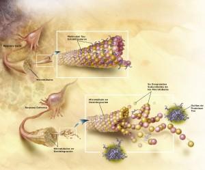 Alzheimer, úlceras y tontos ilustrados