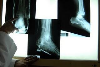 Niños menores de seis años, los más expuestos a accidentes durante fiestas patrias: IMSS