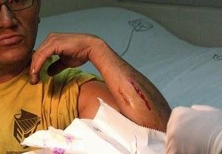 Daño severo al hígado, traumatismos y la muerte, consecuencias más graves por beber alcohol: IMSS