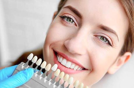 blanqueamiento Clinica Dental Puyuelo