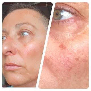 TOPICAL SERUM de Elisabeth Vargas Cosmetic TOPICAL SERUM de Elisabeth Vargas Cosmetic