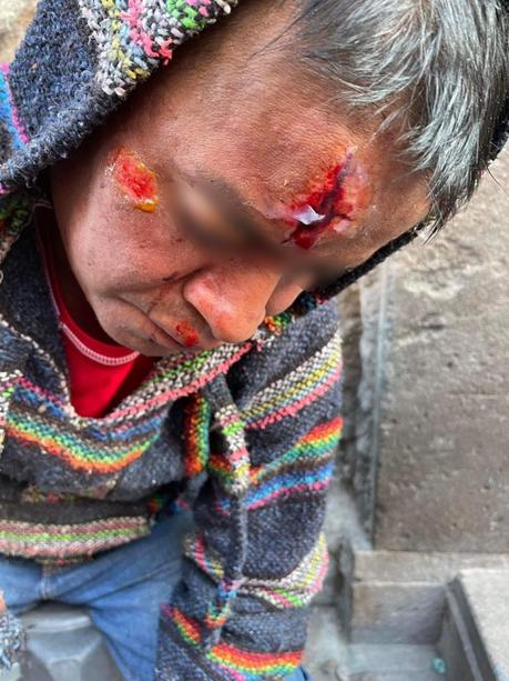 “Hippie” golpea a indígena Triqui en el Callejón de San Francisco