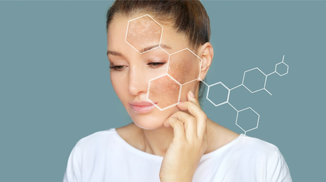 ¿Cuál es el mejor tratamiento de las manchas hormonales o melasma?