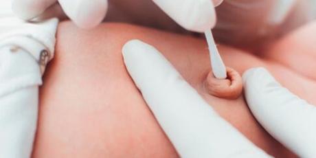 Consejos y cuidados del cordón umbilical de los bebés