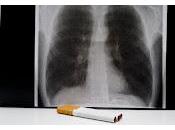 Nuevo objetivo para tratar Enfermedad Pulmonar Obstructiva