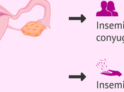 Inseminación post-mortem