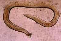 Identifican una posible cura para la Estrongiloidiasis