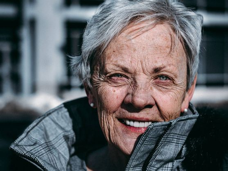 Queratosis actínica: el precáncer que debes vigilar siempre