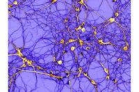 Interruptor molecular para el comportamiento de la Adicción