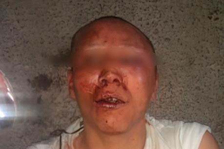 (video) Le sumen la mollera a presunto ladrón en Prados de Soledad