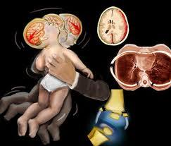 Romperle la cabeza a un niño por desesperación