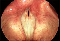 Muerte por anestesia en odontología: respuesta a negligencia médica 15