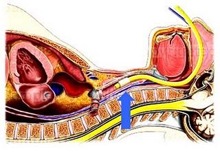 Muerte por anestesia en odontología: respuesta a negligencia médica 15