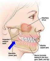 Muerte por anestesia en odontología: respuesta a negligencia médica 15