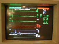 Respuesta a negligencia médica 16: Anestesista a la cárcel