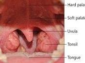 Respuesta negligencia médica Silvia Gallegos operar...
