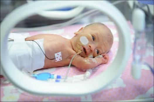 Los análisis realizados a bebés prematuros causan estrés en los padres