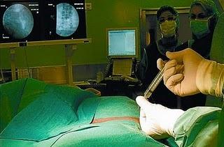 Médicos de Barcelona logran rehacer discos vertebrales con células madre