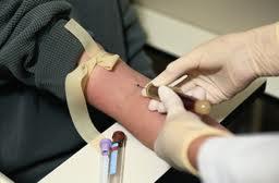 Examen para la detección del VIH