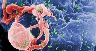 Investigadores desarrollan técnica que desactivara el VIH en el organismo
