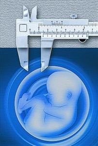 Eugenesia en el diagnóstico genético preimplantacional (DGP)