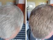 ¿Por elegir color para canas?