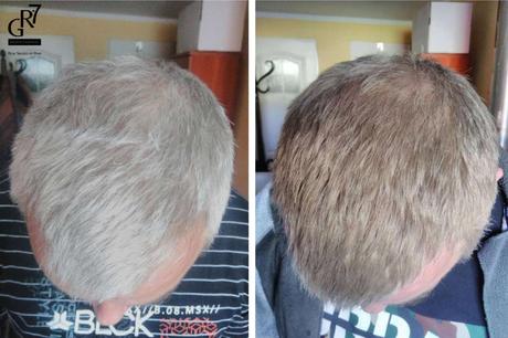 ¿Por qué elegir color para las canas? ¿Por qué elegir color para las canas?