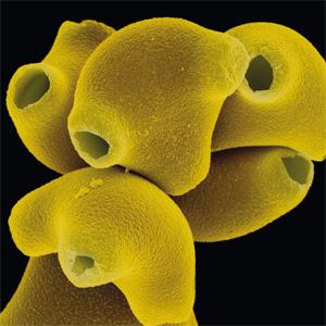 Pólenes en microscopio - Pollens under microscope
