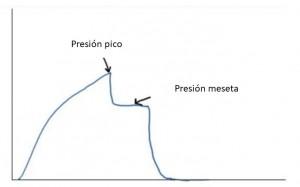 Diapositiva1 VENTILACIÓN MECÁNICA EN LA PRÁCTICA (II)