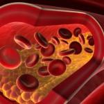 niveles altos colesterol