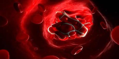 Hipercoagulación – Naturópata en Madrid