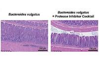 Diagnostico de Colitis Ulcerosa usando una muestra de Heces